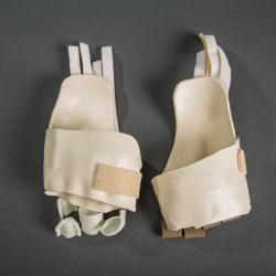 Burn Casts 